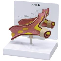 Arterie Modell