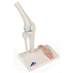 Anatomie Modell Kniegelenk Mini  mit Querschnitt / Bild 1
