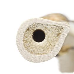Elle rechts, (Ulna), ORTHObones Premium / Bild 3