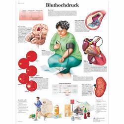 Lehrtafel - Bluthochdruck