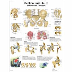 Lehrtafel - Becken und Hüfte - Anatomie und Pathologie