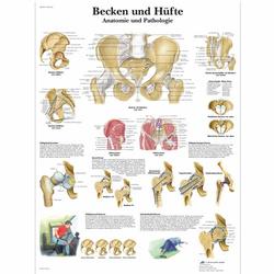 Lehrtafel - Becken und Hüfte - Anatomie und Pathologie