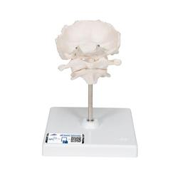 Atlas und Axis Modell mit Hinterhauptschuppe auf Stativ / Bild 1