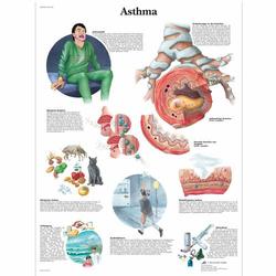 Lehrtafel - Asthma / Bild 1