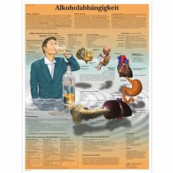 Lehrtafel - Alkoholabhängigkeit / Bild 1