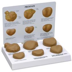 Prostata Modell Grösse 22,2 x 13,3 x 2,5 cm / Bild 1