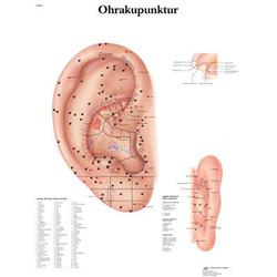 Lehrtafel - Ohrakupunktur papier