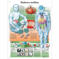 Lehrtafel - Diabetes melllitus / Bild 1