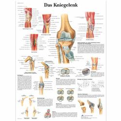 Lehrtafel - Das Kniegelenk / Bild 1