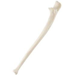 Elle, Ulna, links, ORTHObones Standard