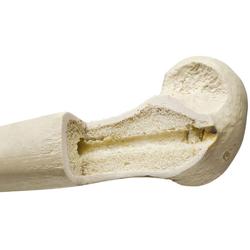 Schienbein (Tibia) links, ORTHObones Premium  / Bild 2