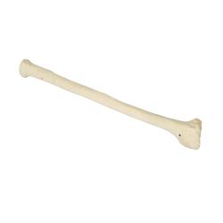 Speiche (Radius) links, 3B Scientific® ORTHObones 