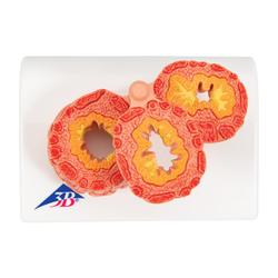 COPD Lungenmodell - 3B Smart Anatomy / Bild 7