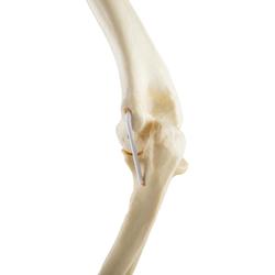 Ellbogen  links, ORTHObones Standard