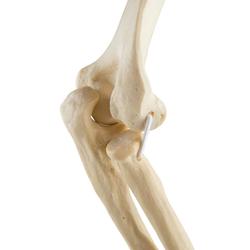 Ellbogen  links, ORTHObones Standard / Bild 5