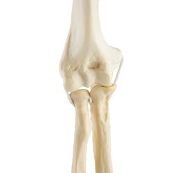 Ellbogen  links, ORTHObones Standard / Bild 6