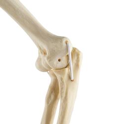 Ellbogen  links, ORTHObones Standard / Bild 7