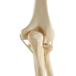 Ellbogen  links, ORTHObones Standard / Bild 8