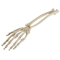 Hand & Handgelenk, ORTHObones Standard