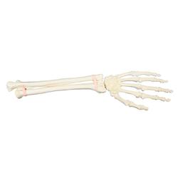 Hand und Unterarm, links, ORTHObones Premium 