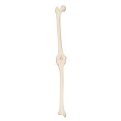 Linkes Knie, 3B Scientific® ORTOHbones Premium 