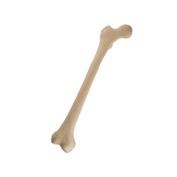 Oberschenkelknochen, rechts, Femur jugendlich, rechts
