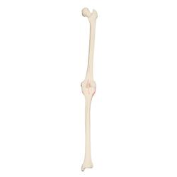 Rechtes Knie, 3B Scientific® ORTHObones Premium 