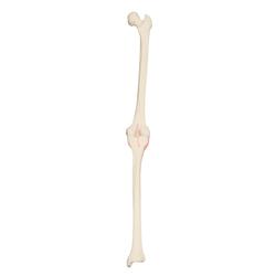 Rechtes Knie, 3B Scientific® ORTHObones Premium  / Bild 1