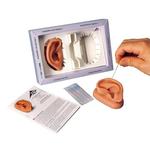 Ohr Akupunktur linkes und reches Ohr mit 5 B-Typ Nadeln / Bild 1