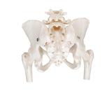Becken-Skelett Modell weiblich mit Oberschenkelstümpfen / Bild 4