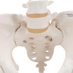Becken-Skelett Modell weiblich mit Oberschenkelstümpfen / Bild 6