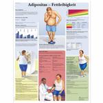 Lehrtafel - Adipositas - Fettleibigkeit / Bild 1