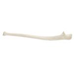 Elle, Ulna, links, ORTHObones Standard / Bild 2