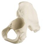 Becken männlich, Pelvis, links, ORTHObones Standard / Bild 1