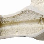 Femur  links, 3B Scientific® ORTHObones Premium  / Bild 2