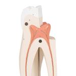Oberer dreiwurzeliger Molar, 3- teilig / Bild 5