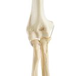 Ellbogen  links, ORTHObones Standard / Bild 6