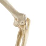 Ellbogen  links, ORTHObones Standard / Bild 7