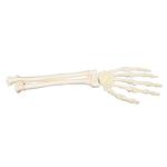 Hand und Unterarm, links, ORTHObones Premium  / Bild 1